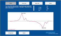 Sage Casting Analyzer - Symmetry